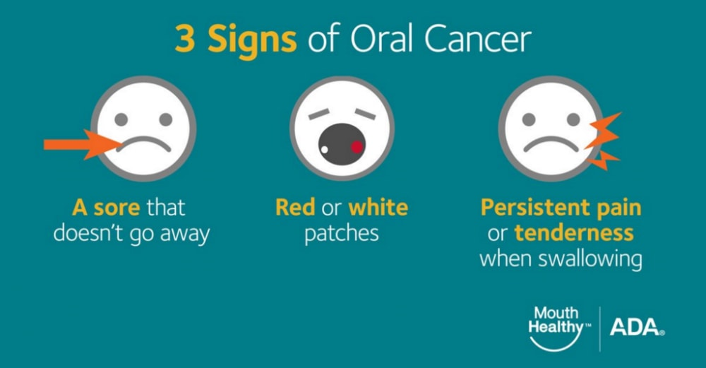 Oral Cancer Early Cancer Detection Treatment Success Rates and Costs in